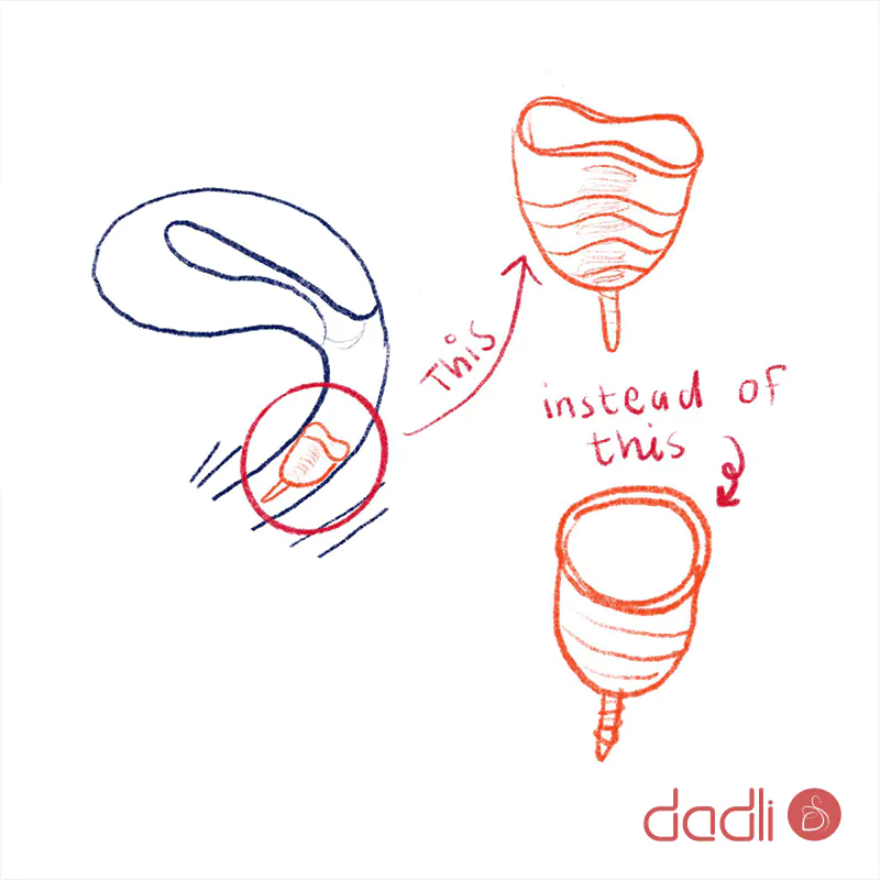 باز شدن و فیکس شدن کاپ قاعدگی